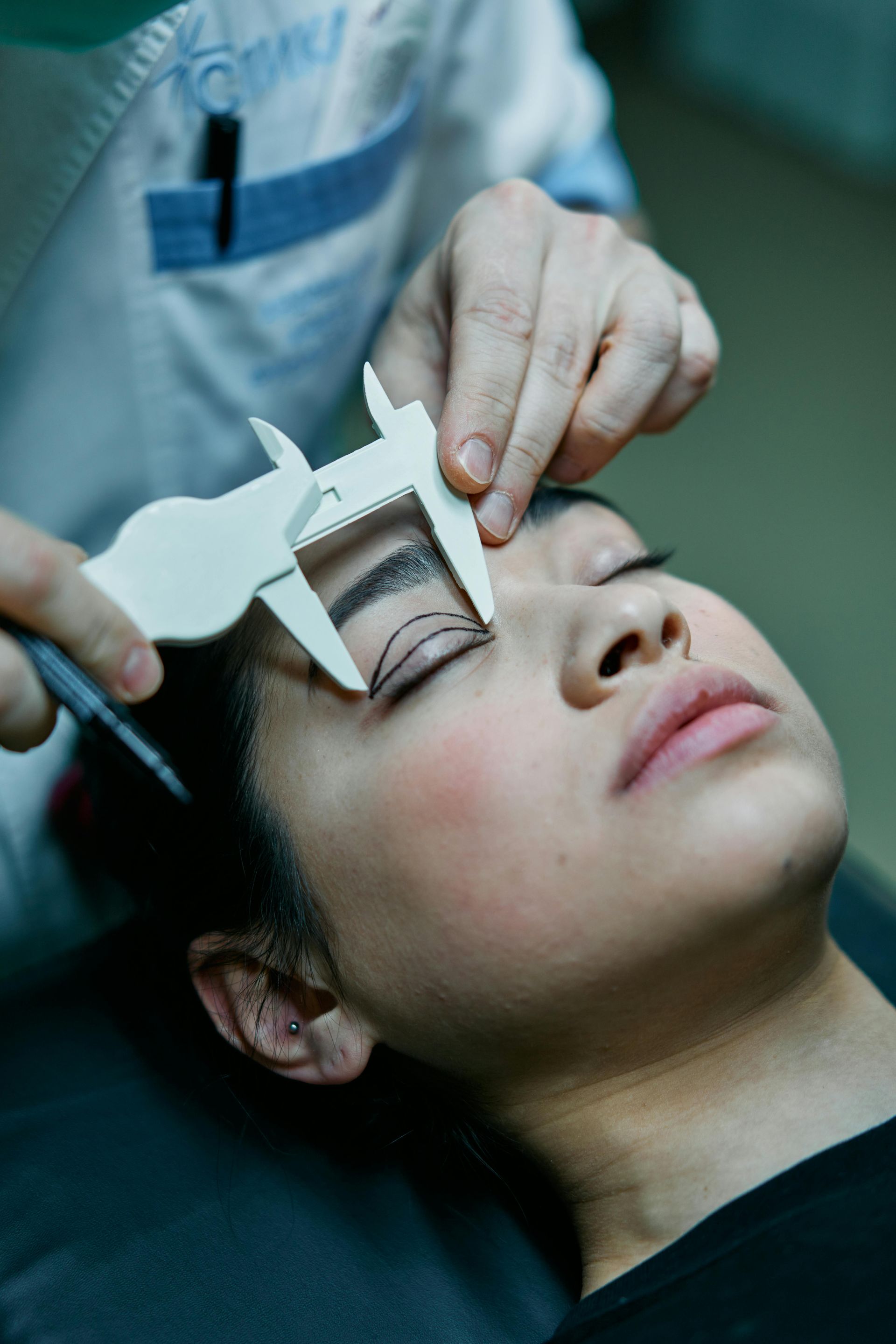 Person's eye measured with calipers, likely for a cosmetic procedure.