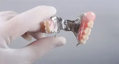 chrome dentures