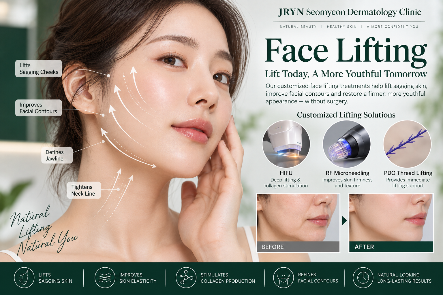 Face lifting treatment at JRYN Seomyeon Dermatology Clinic in Busan