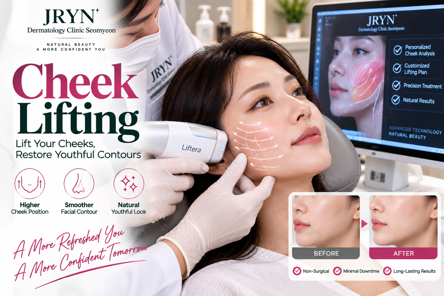 Cheek Lifting treatment concept and facial contour explanation at JRYN Seomyeon Dermatology Clinic Busan
