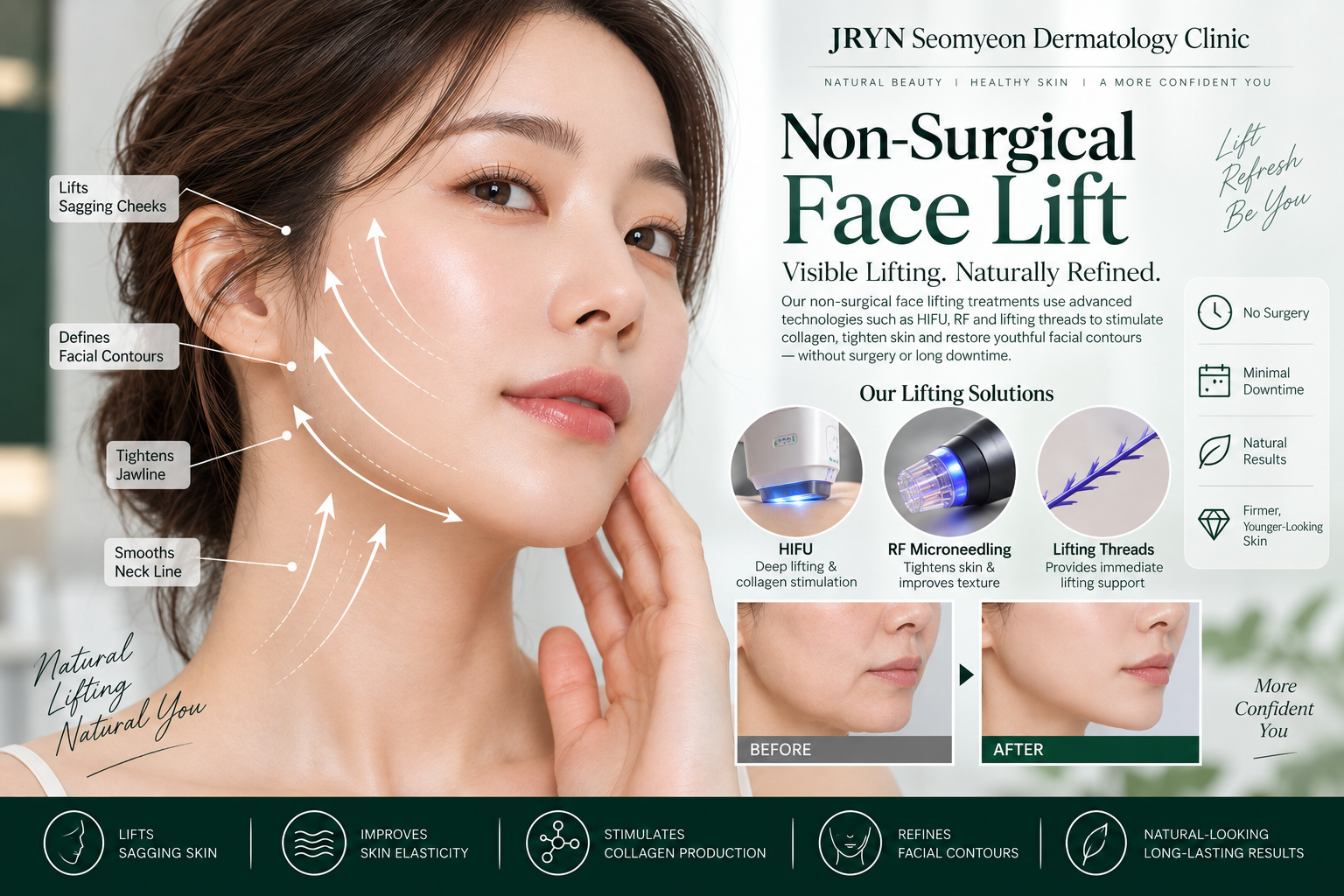 Non-surgical face lift procedure at JRYN Seomyeon Dermatology Clinic