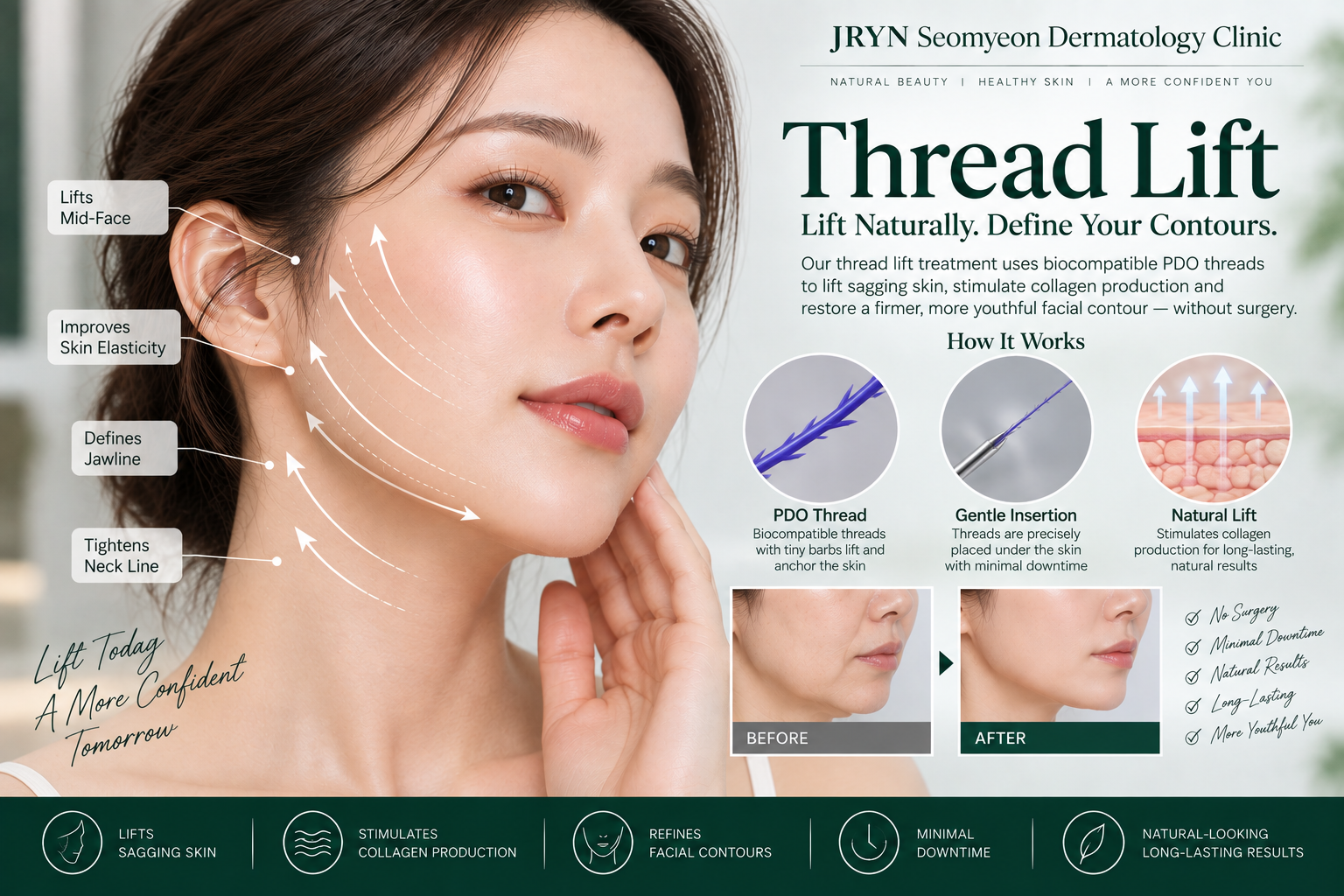 Thread lift procedure at JRYN Seomyeon Dermatology Clinic