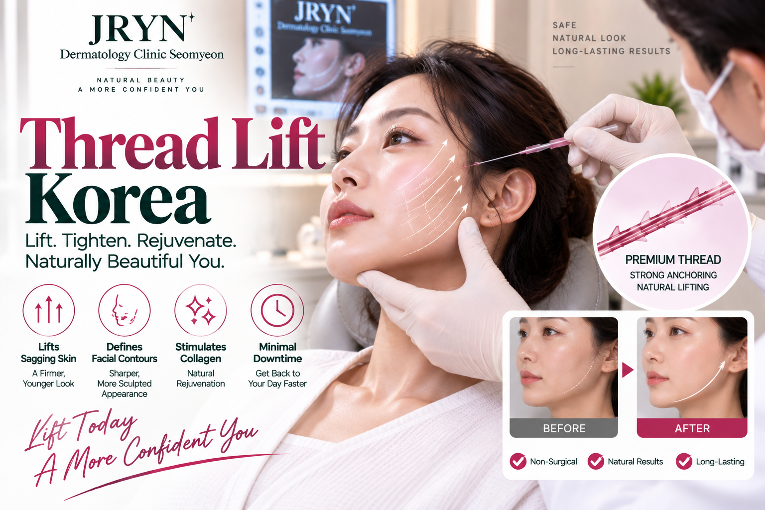 Thread Lift and non-surgical facial lifting concept at JRYN Seomyeon Dermatology Clinic Korea