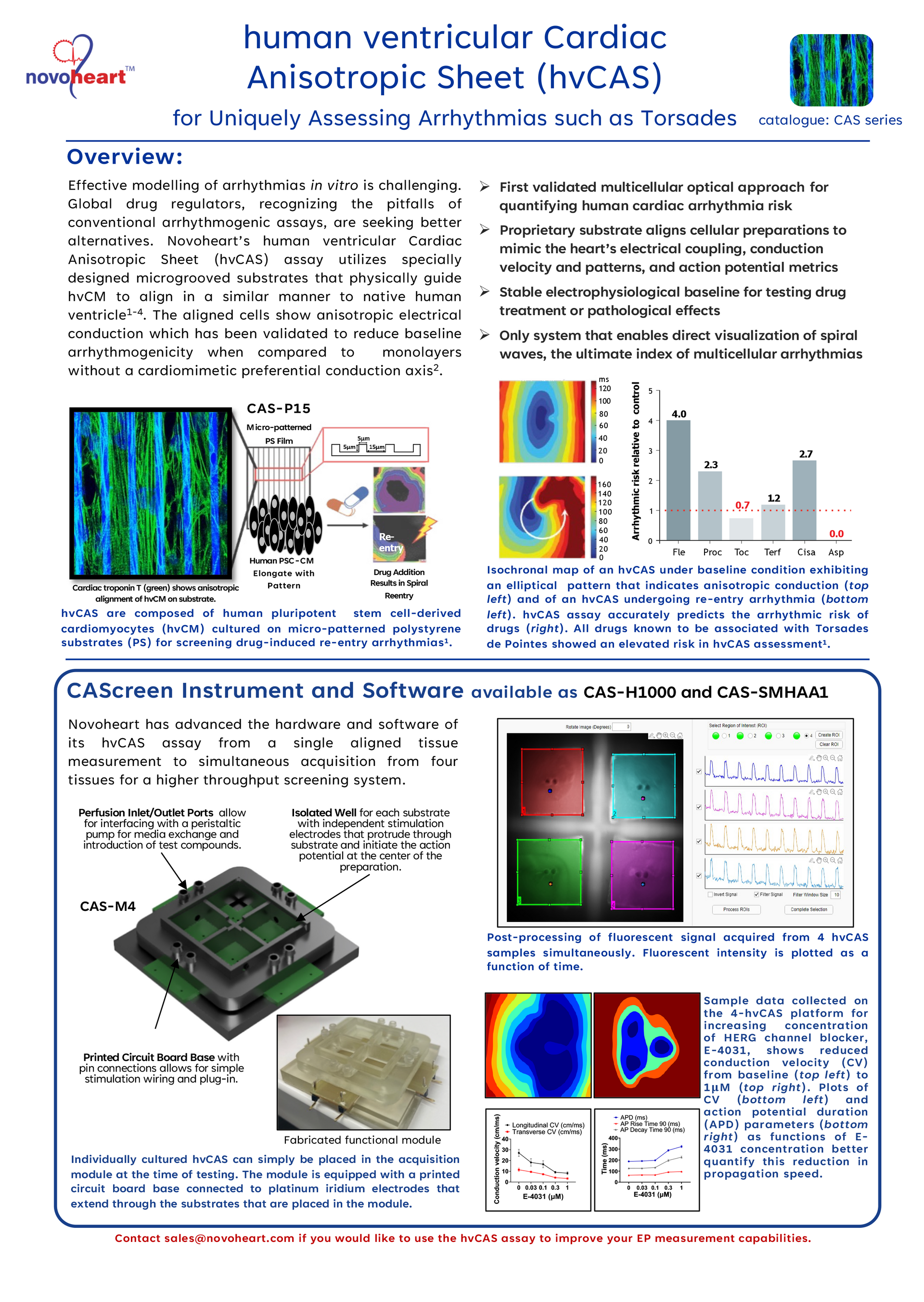 human ventricular Cardiac Anisotropic hvCAS