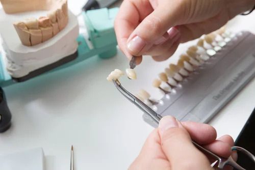Dentista com software de odontograma em clínica moderna. Mãos segurando coroas dentárias com pinças, comparando-as com uma escala de cores.