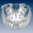 3D Xray Imaging