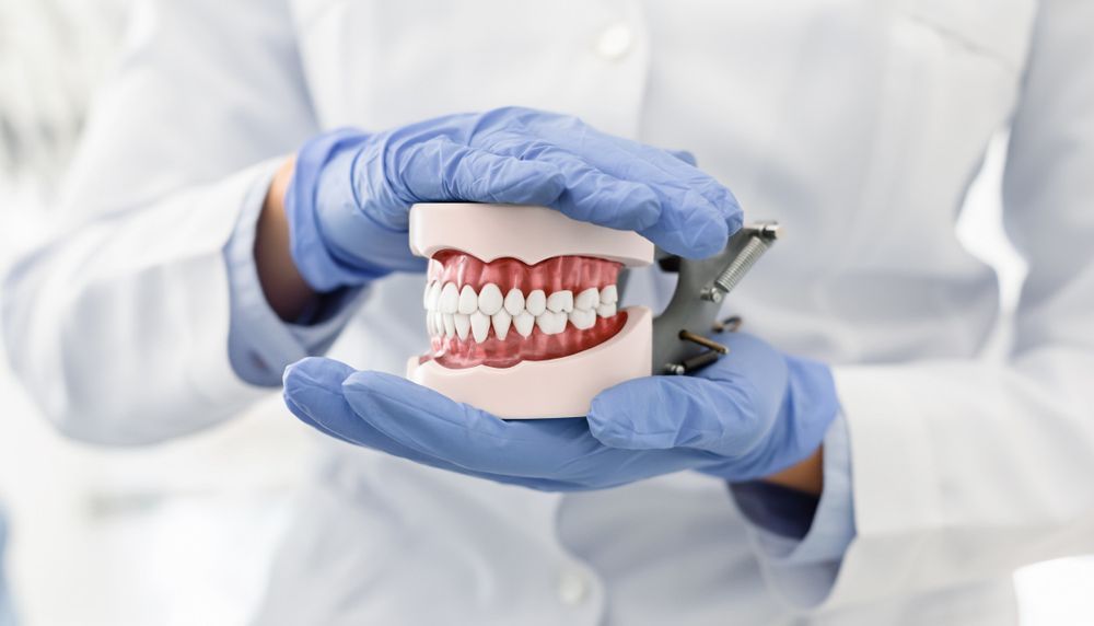 A Dentist Is Holding a Model of Teeth in His Hands — Bromley's Denture Clinic in Tweed Heads South, NSW