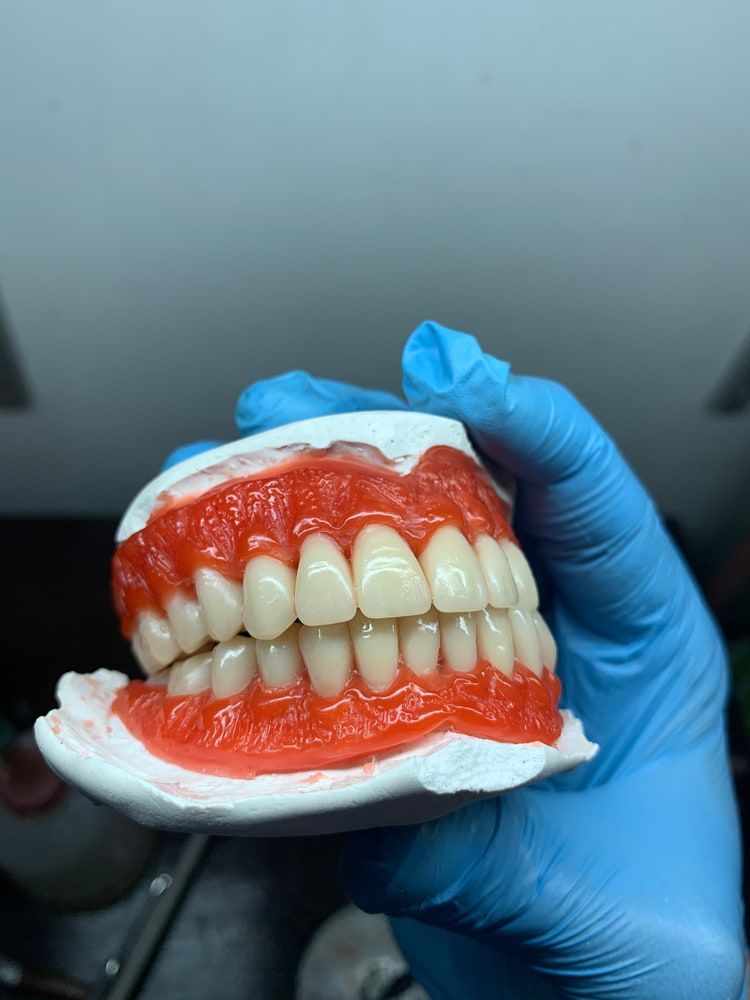 A Person Wearing Blue Gloves Is Holding a Model of Teeth — Bromley's Denture Clinic in Tweed Heads South, NSW