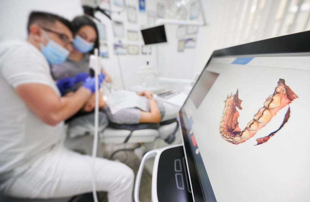 A Model of A Person's Teeth with A Dental Bridge — Bromley's Denture Clinic in Tweed Heads South, NSW