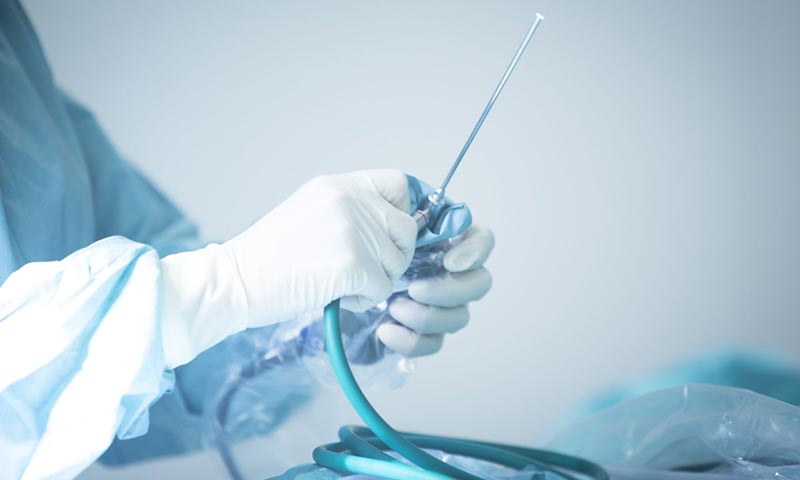 Imagem ilustrativa sobre procedimento de cirurgia endoscópica da coluna com técnica minimamente invasiva