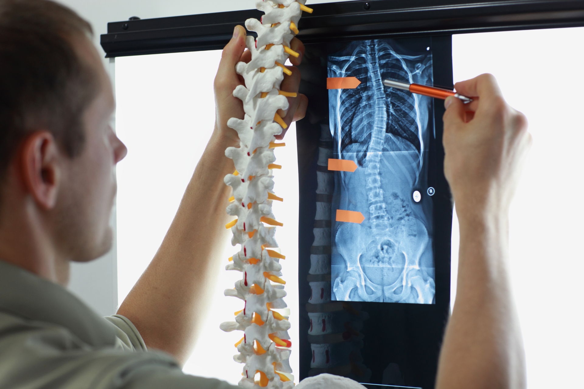 Ilustração de avaliação de escoliose com análise da coluna vertebral em exame de imagem