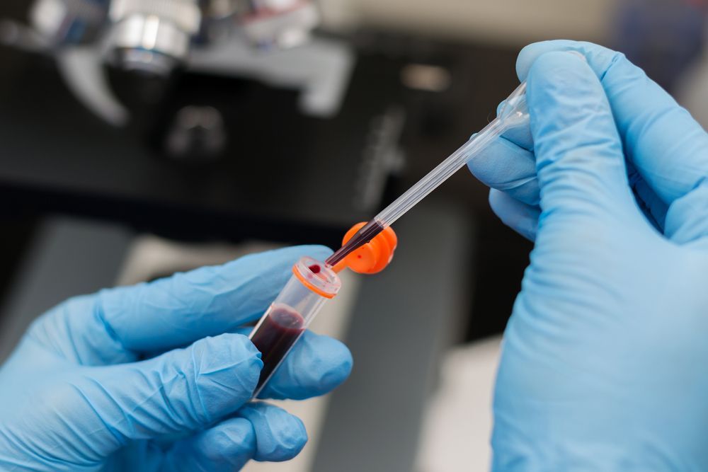 Pet Blood Work — Currumbin, QLD — Currumbin Vet Surgery Pet Blood Work — Currumbin, QLD — Currumbin Vet Surgery