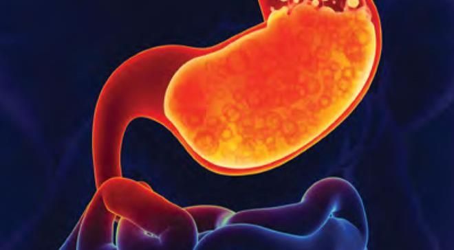 GERD Treatment: Symptoms, Stages, and Clinical Trials