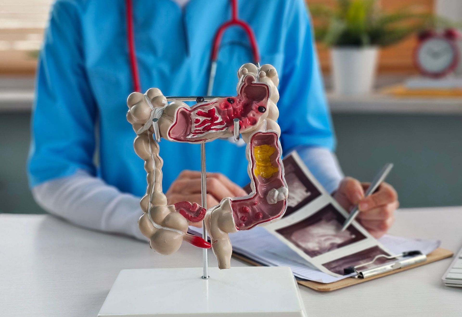 The Role of Diet in Inflammatory Bowel Disease Care