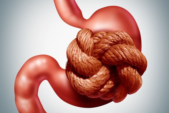 El estreñimiento es un problema gastrointestinal común