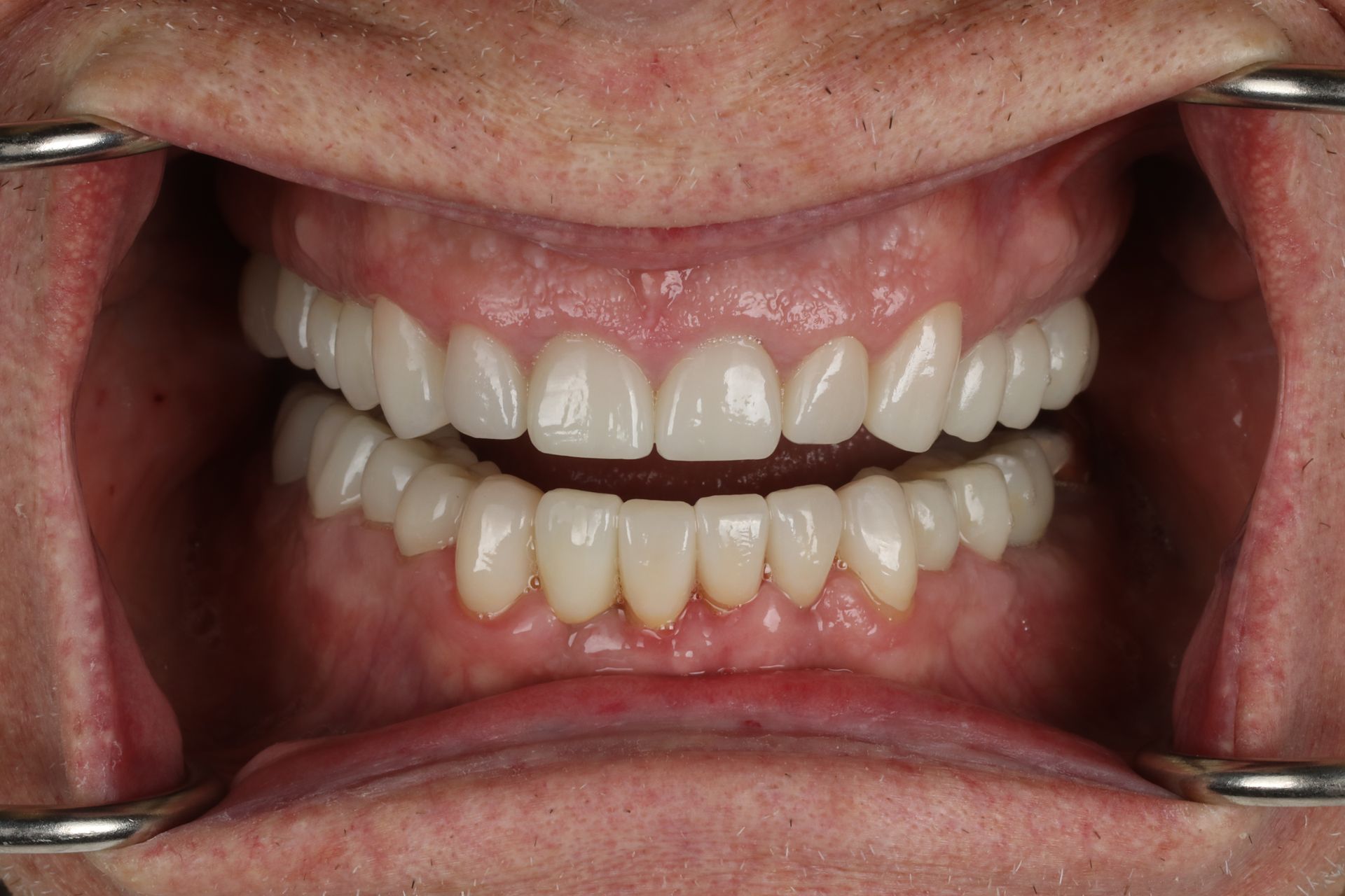 Close-up of a person smiling, showing white teeth, and lips.
