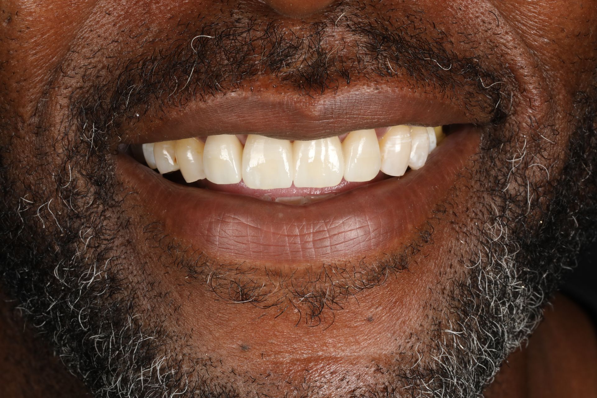 Close-up of a person smiling, showing white teeth, and lips.