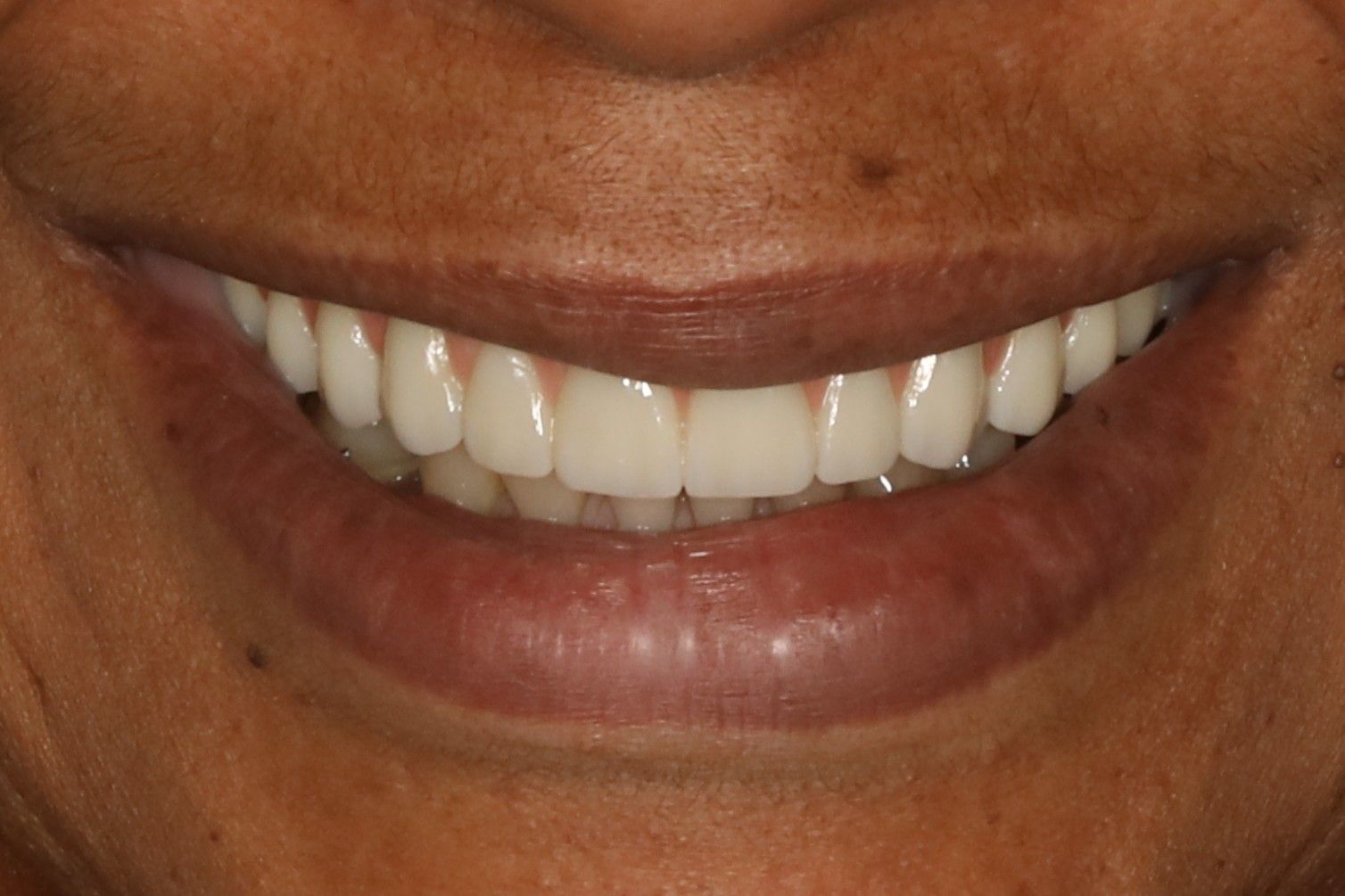 Close-up of a person smiling, showing white teeth, and lips.