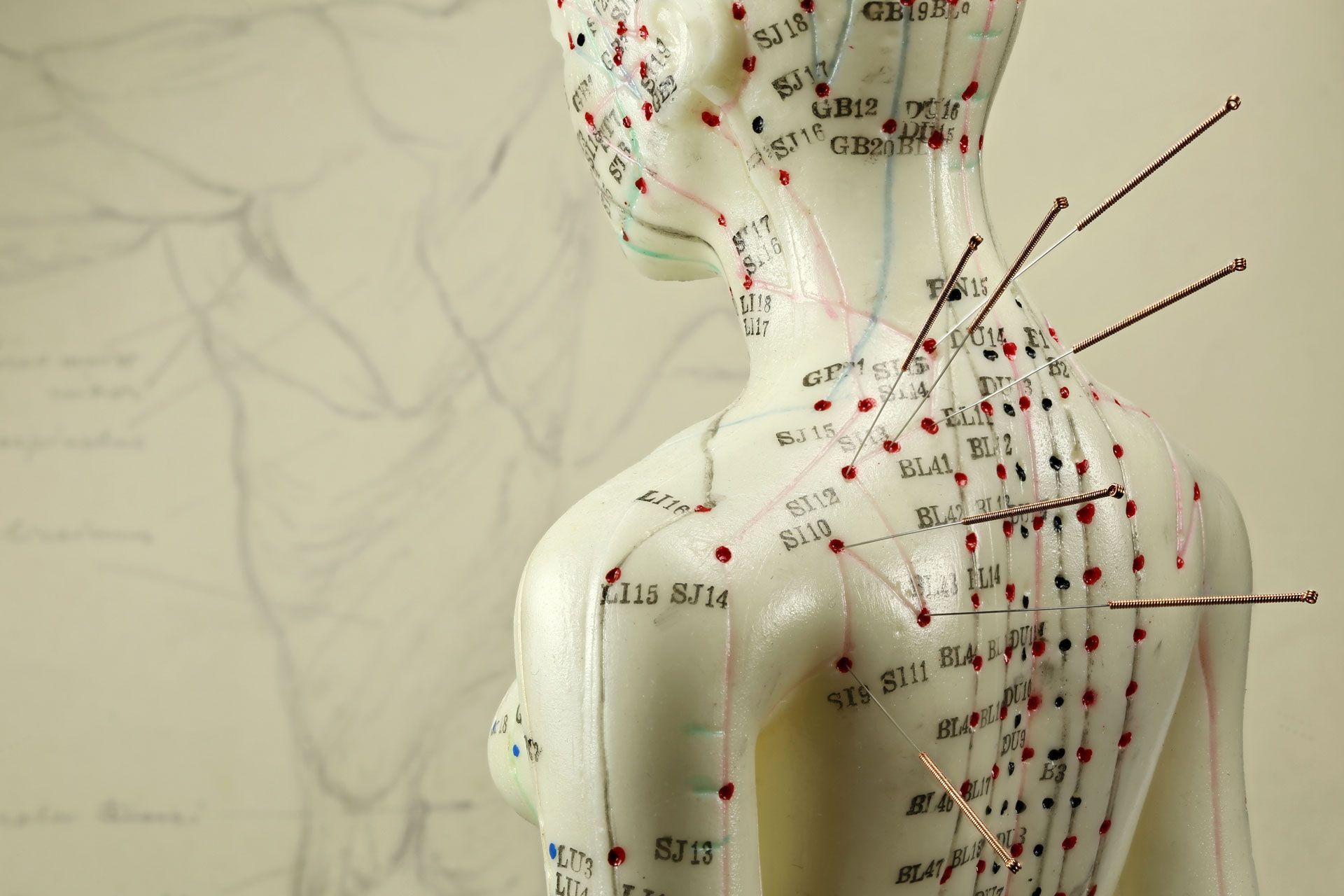 A model torso with acupuncture needles inserted at various points, with a diagram in the background.