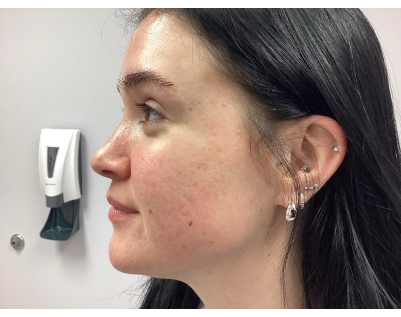 Profile of a person with dark hair in a white room, standing beside a wall-mounted dispenser