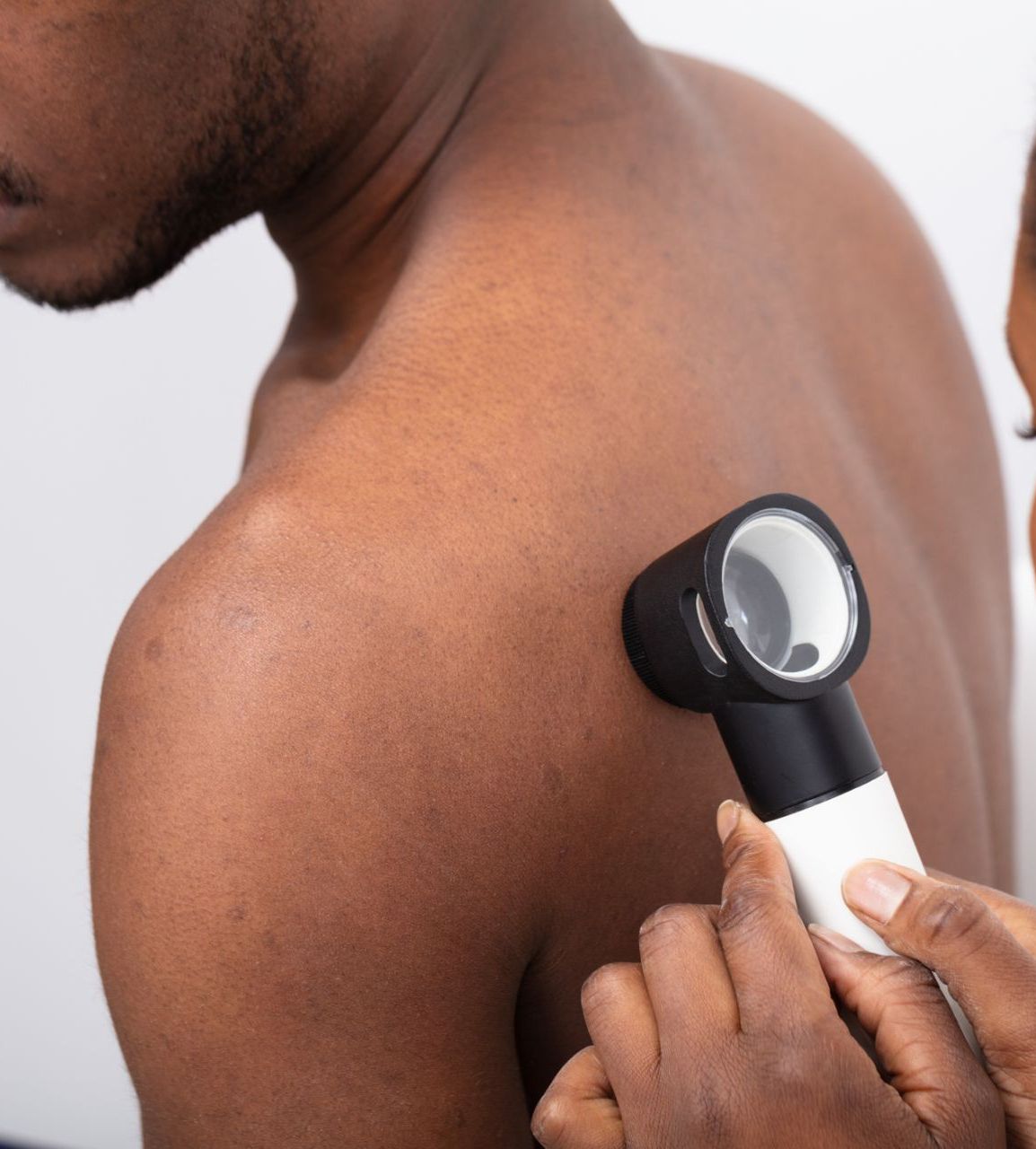 dermatologist examines black male patient's back