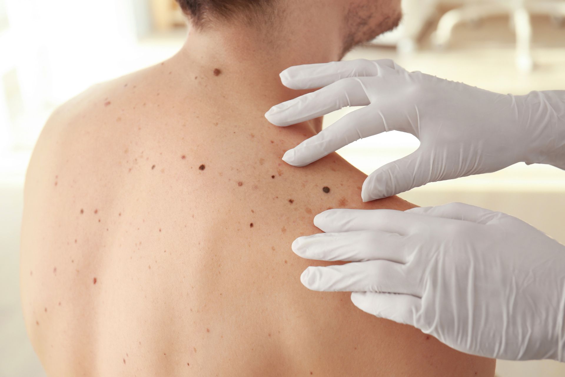 dermatologist examines patients back during skin exam