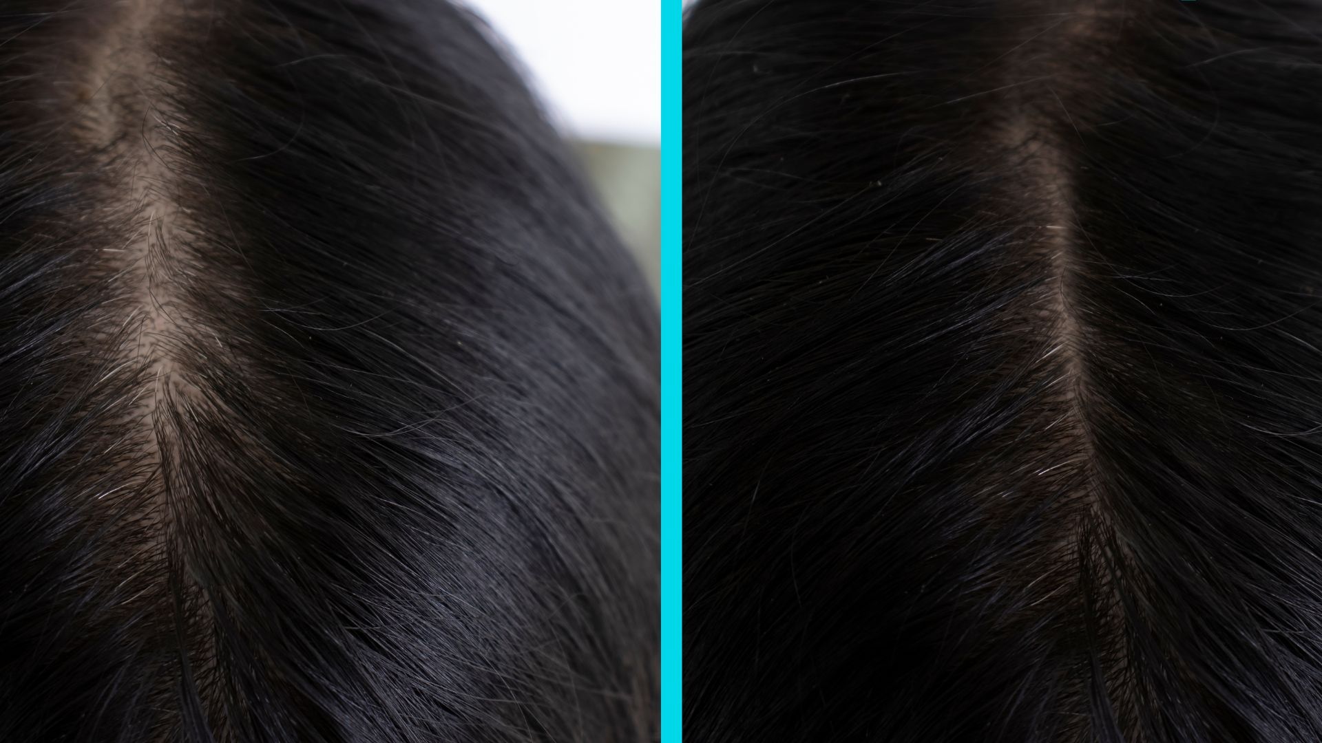 Split close-up of dark hair part, showing scalp visibility on both sides