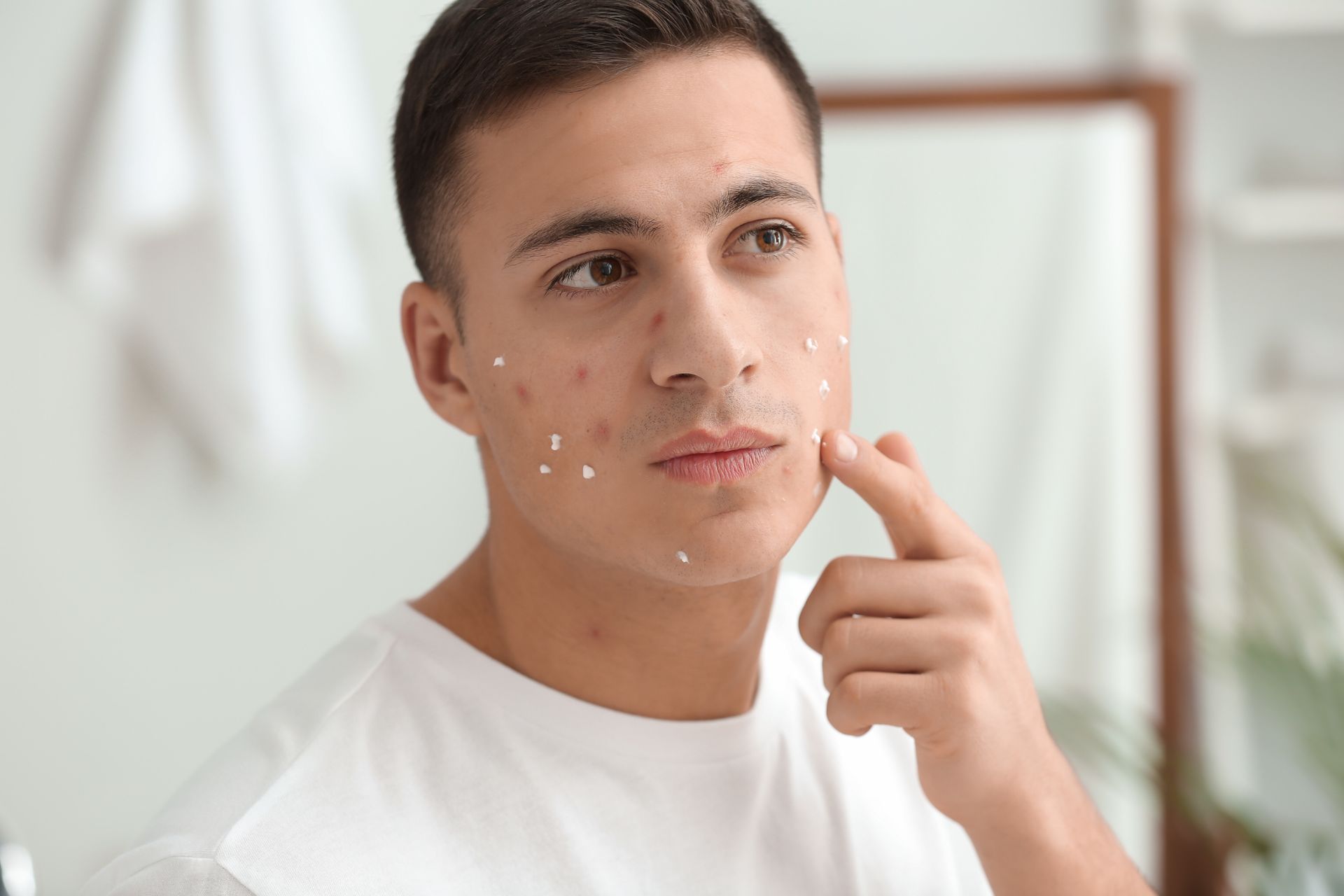 young hispanic man applies acne cream to face pimples