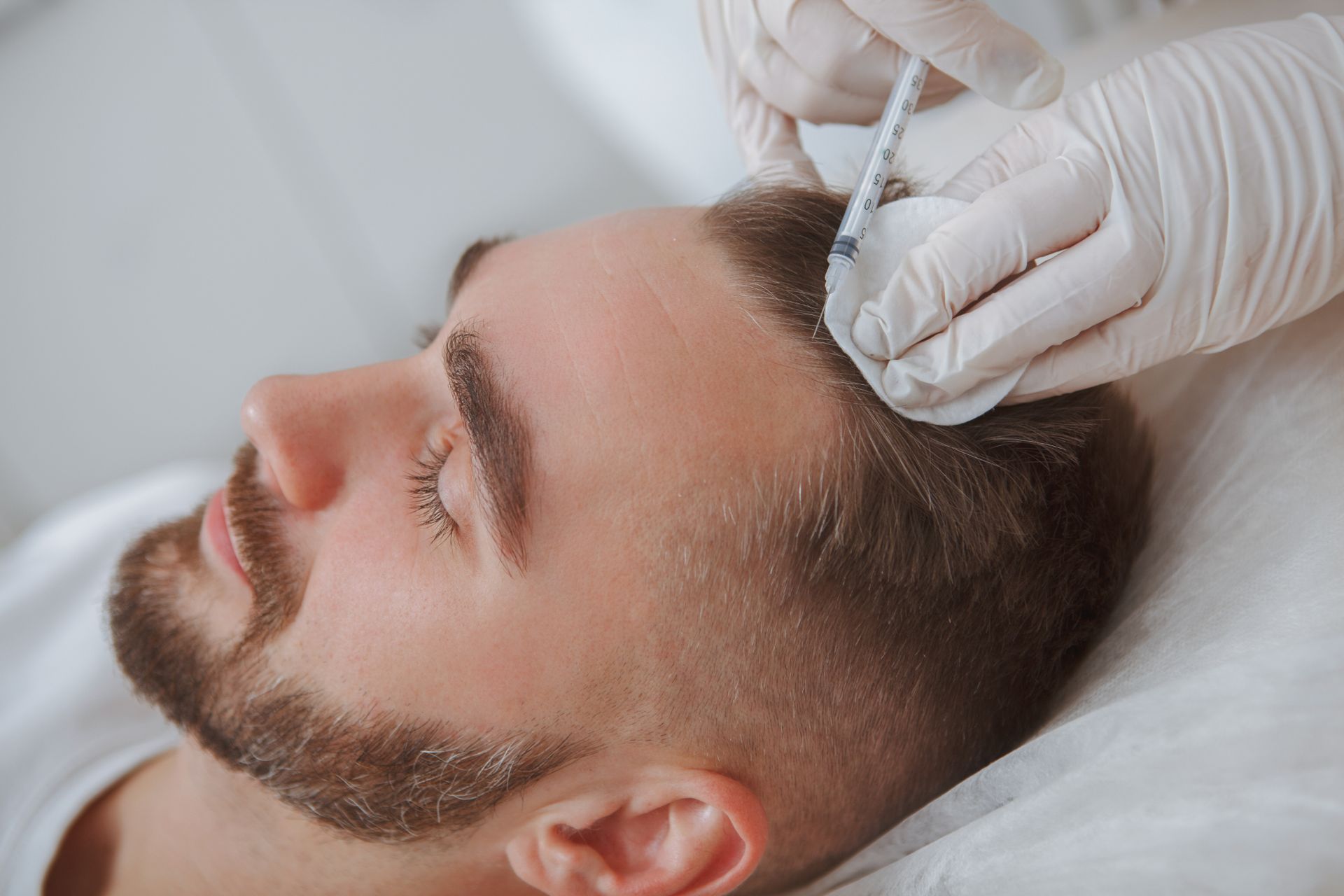 young white man receives hair loss treatment injections