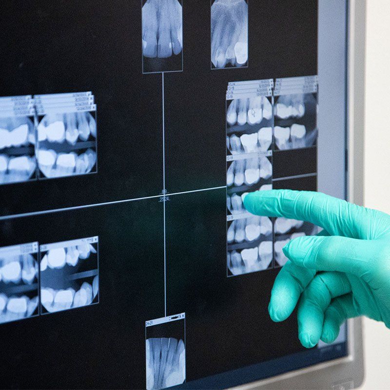 A Dentist Wearing Surgical Gloves Pointing to An X-Ray of Teeth — Bunbury WA — FADC Dental Group A Dentist Wearing Surgical Gloves Pointing to An X-Ray of Teeth — Bunbury WA — FADC Dental Group