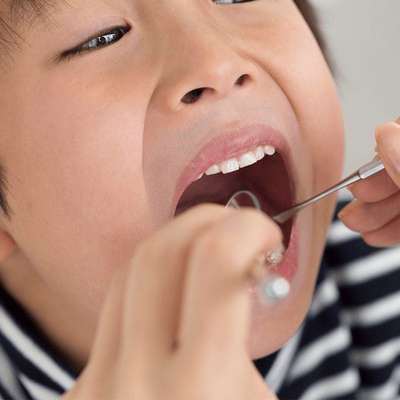 Dental Treatment — Bunbury WA — FADC Dental Group Dental Treatment — Bunbury WA — FADC Dental Group