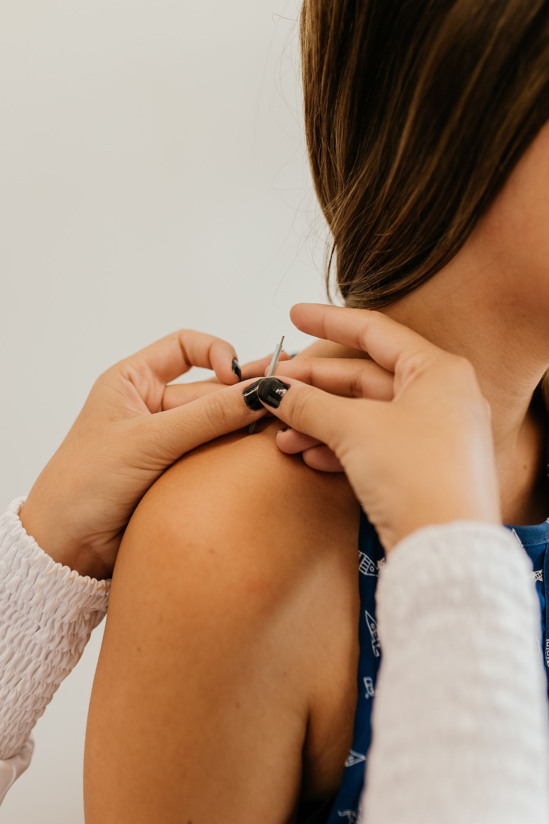 Person receiving acupuncture on shoulder. Light skin, white background.