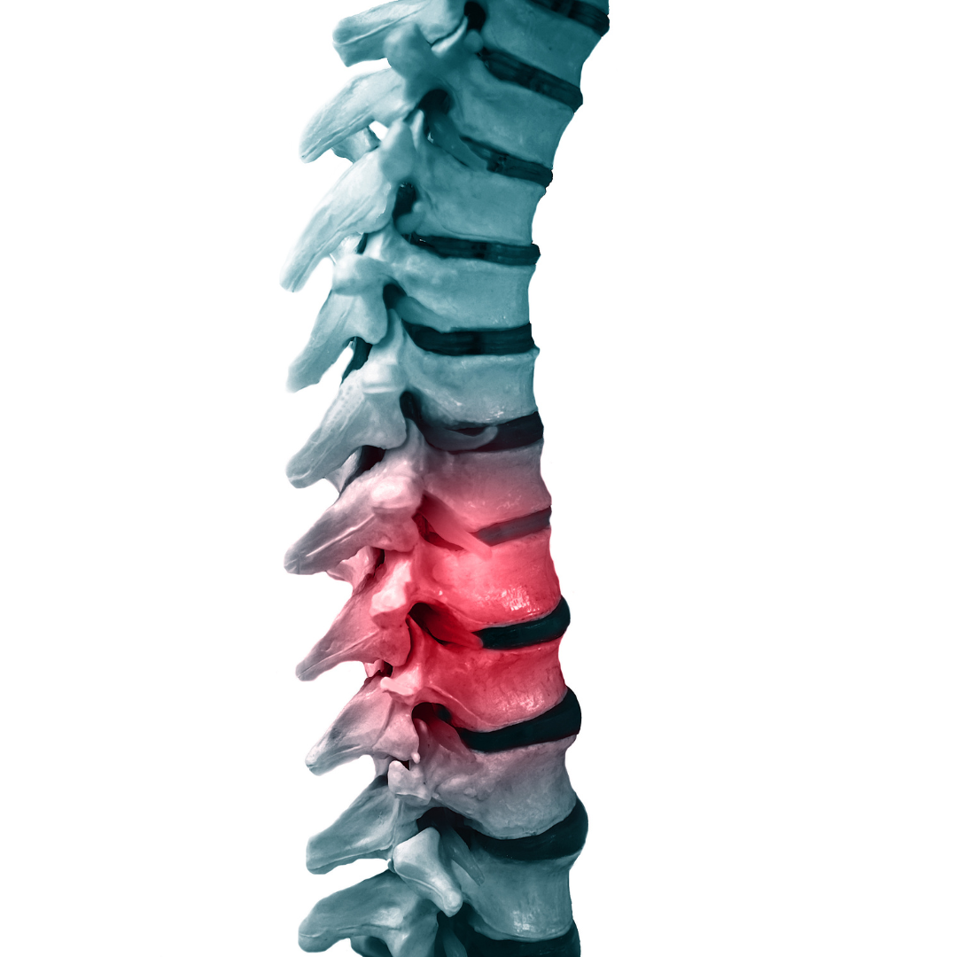 Spinal column, showing red highlight indicating inflammation or injury.