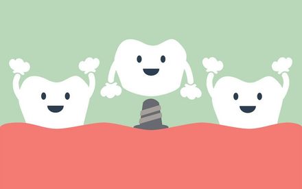 Happy cartoon dental implant Happy cartoon dental implant
