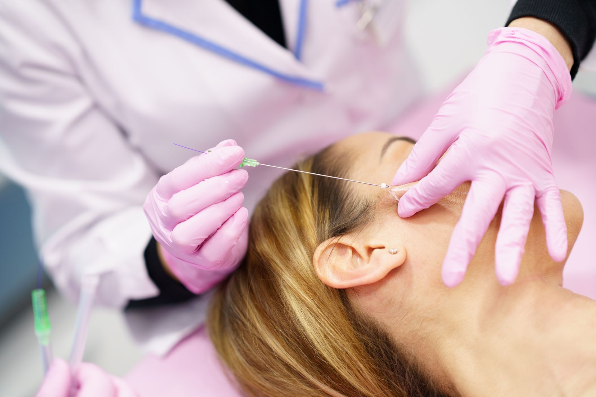 a woman is getting a thread lifting treatment