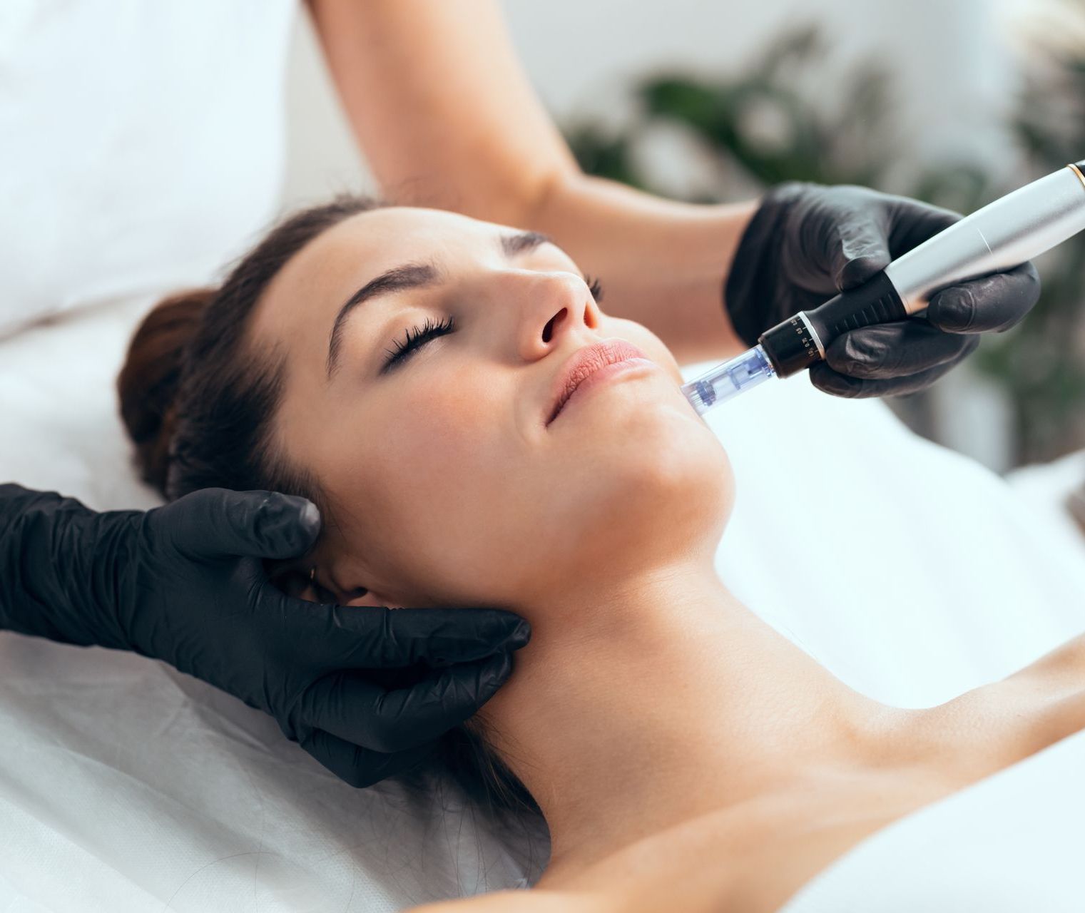 a woman is getting a facial treatment with a device that says ' derma pen ' on it
