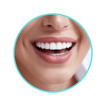 Teeth Whitening service results in Pittsburgh by Effortless Beauty PGH.