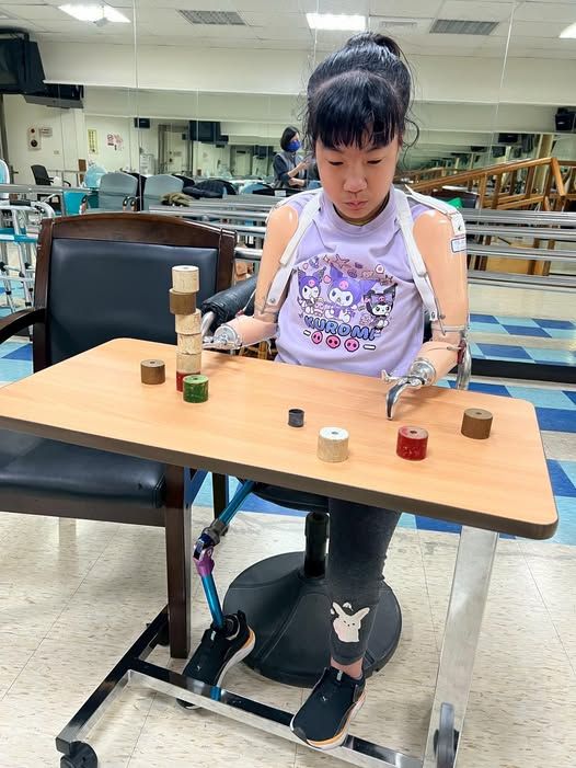 弱勢補助計畫實景:一名穿著紫色上衣的女孩在練習使用上肢義肢,展現平價義肢方案協助傷友重拾生活自理能力的過程。