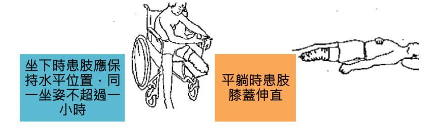 術後正確姿勢教學:展示坐姿時患肢保持水平位置,以及平躺時殘肢膝蓋伸直的正確擺放方式,並輔以藍色與橘色圖說標示。
