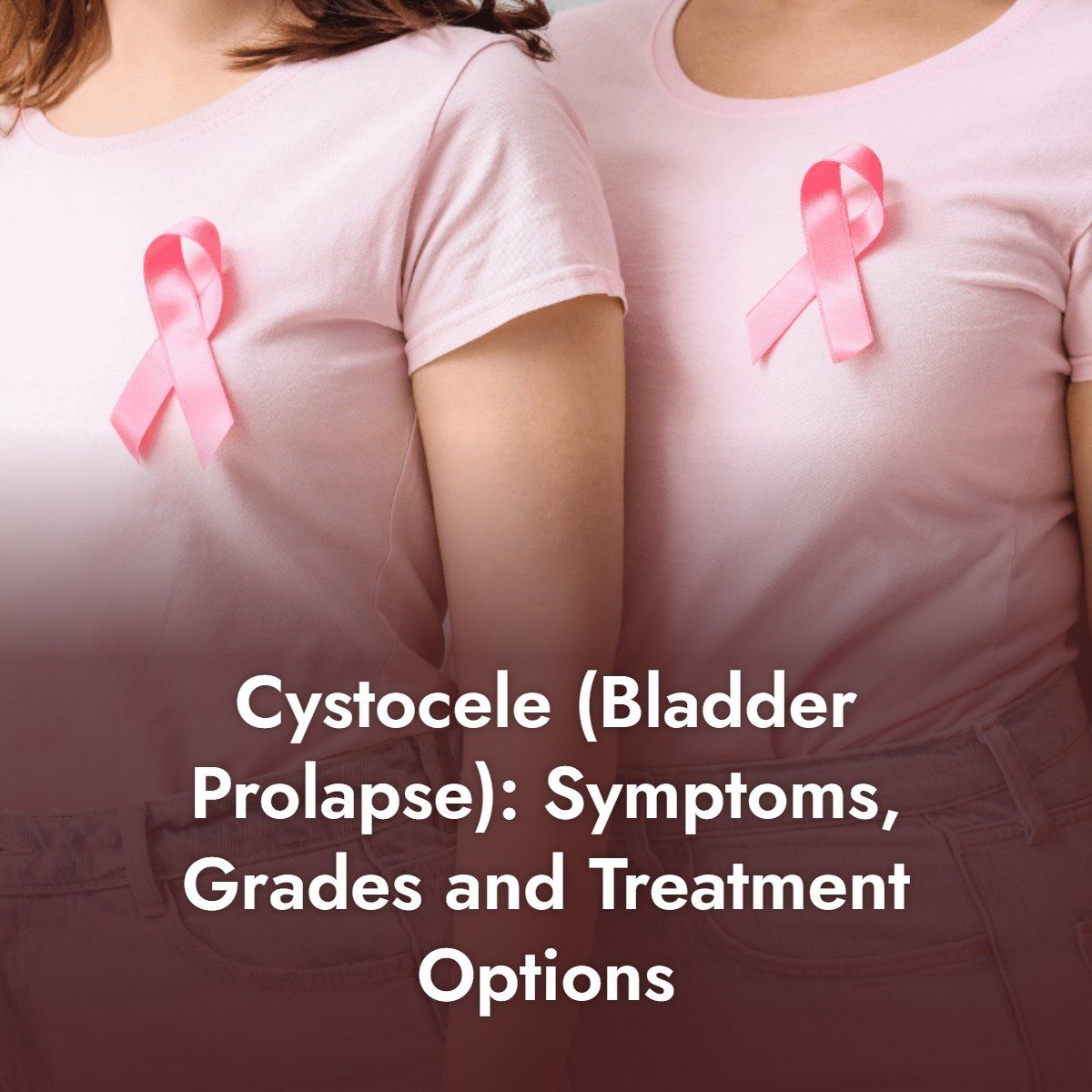 Gynecologist explaining cystocele bladder prolapse grades to a female patient using a pelvic model