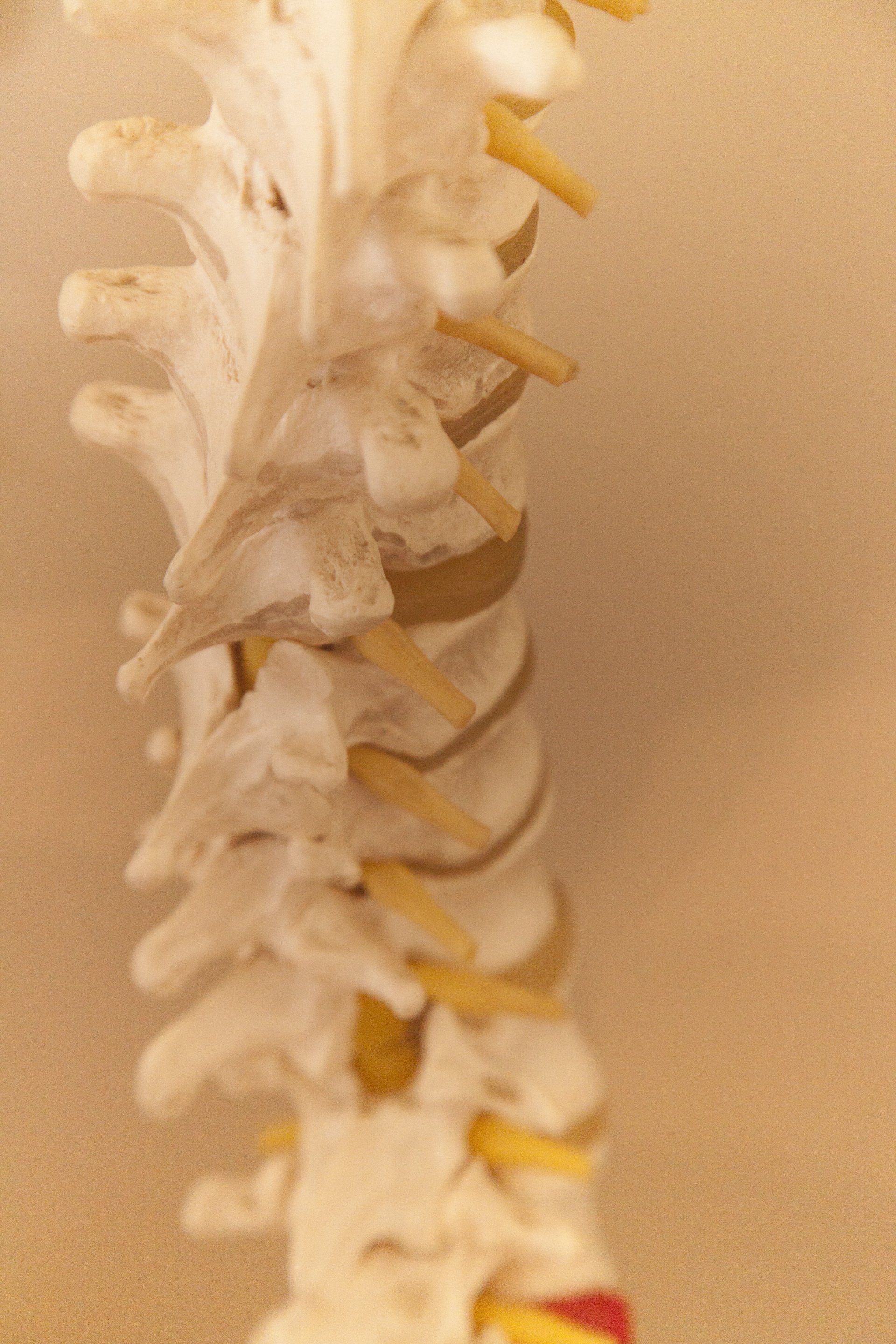 Spine Model — Camden, NSW — Vicki Patterson Chiropractic