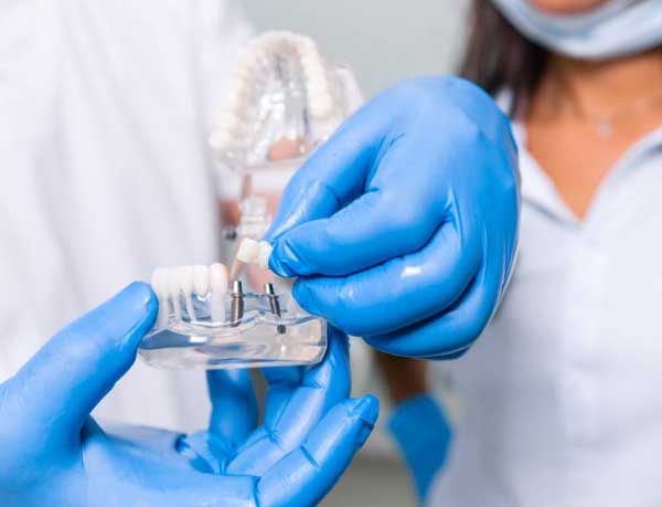 Actual patient case study showing the location and information about the dental implant.