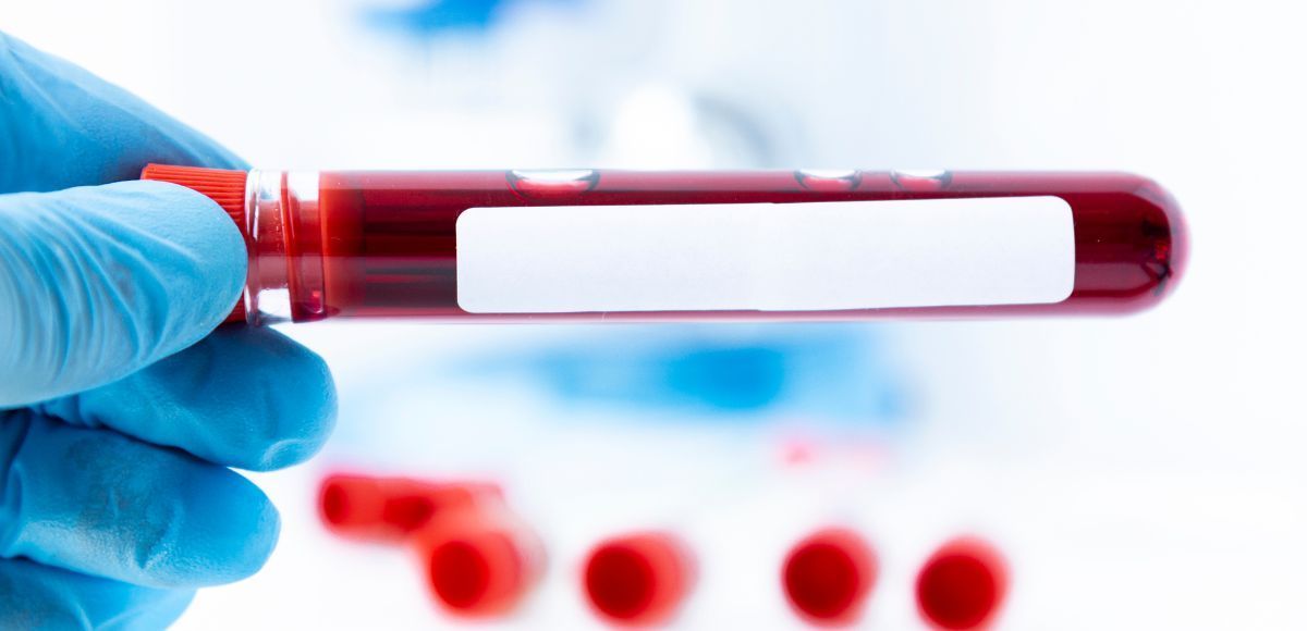 Gloved hand holding a blood sample tube with red liquid and a blank label