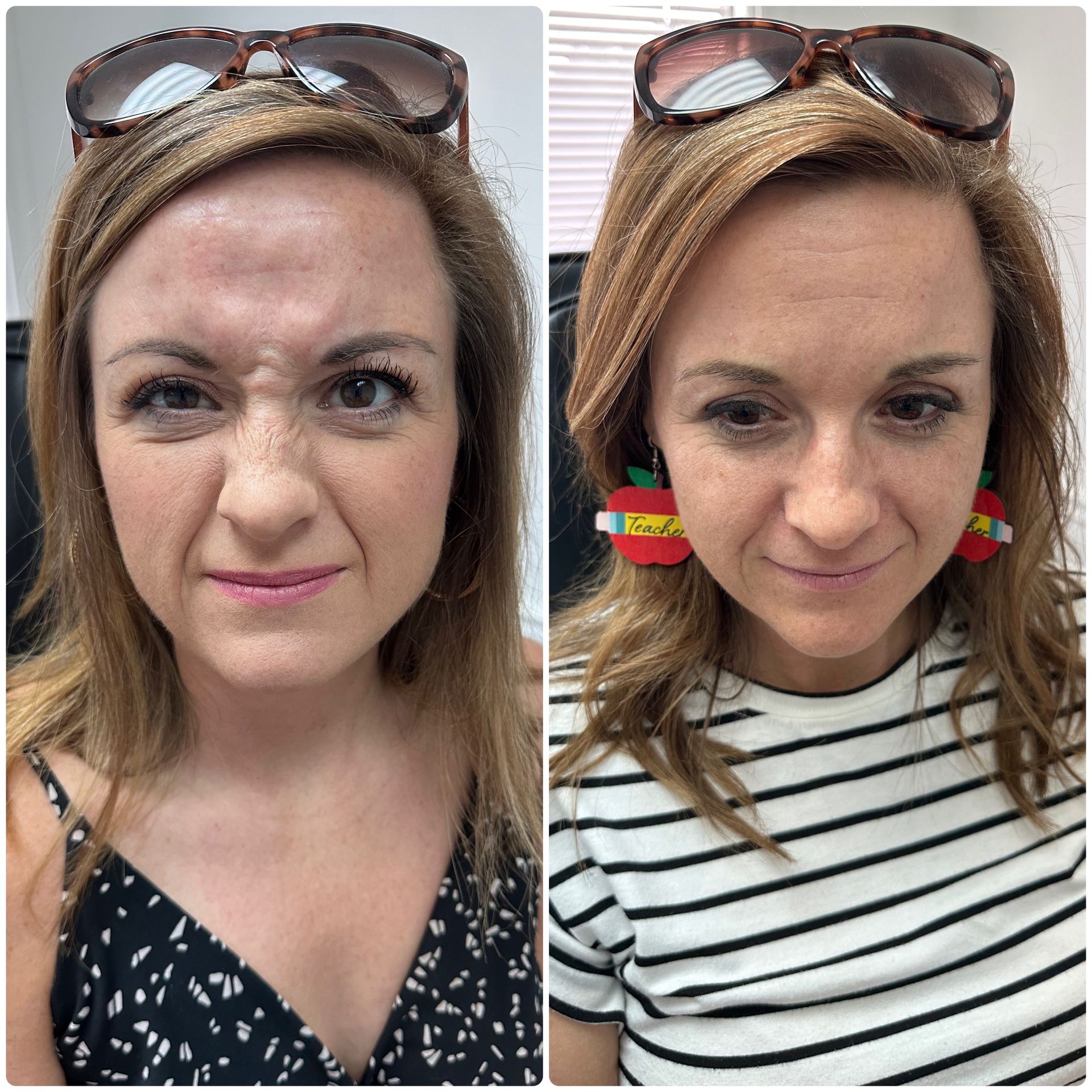 A before and after photo of a woman wearing sunglasses and earrings.