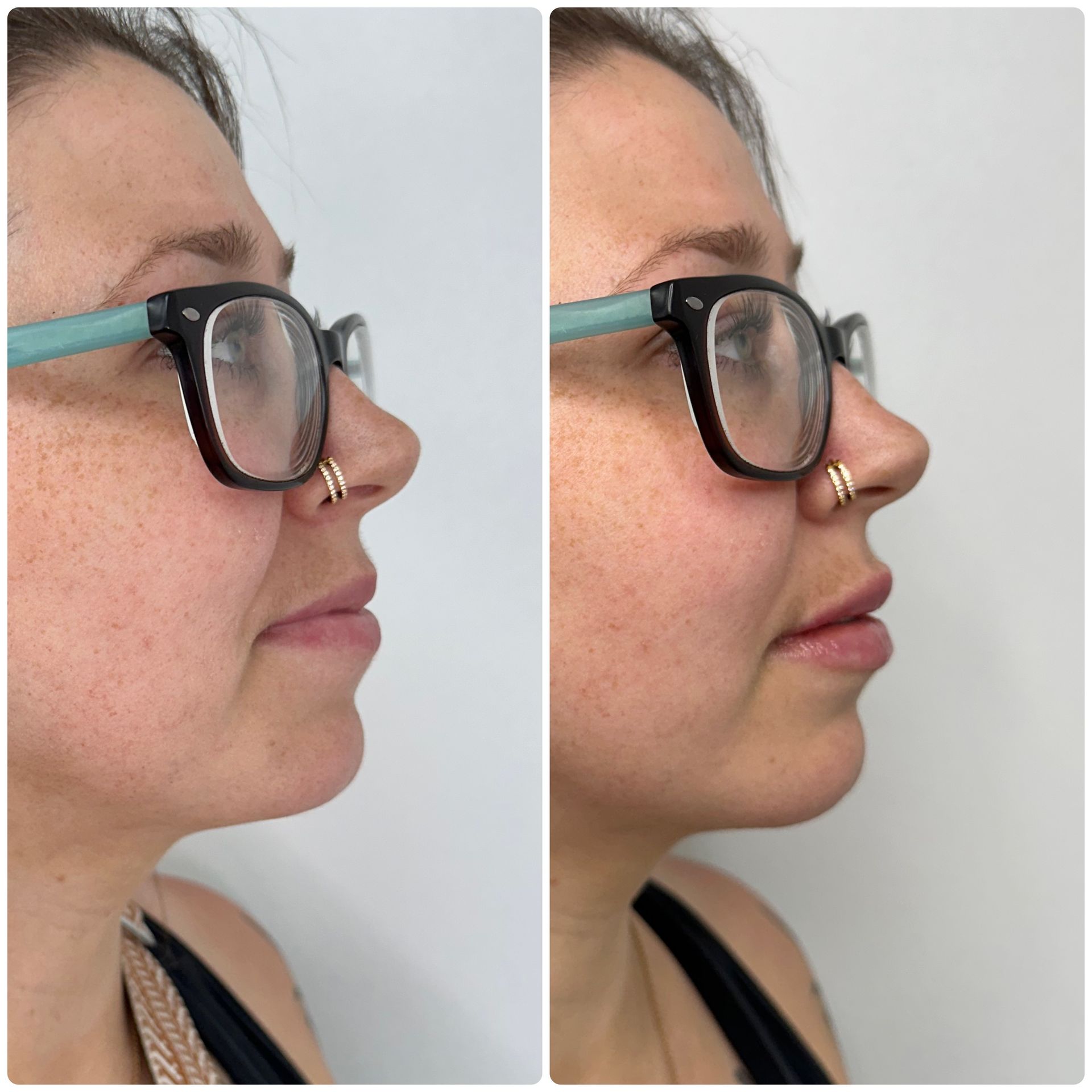 A before and after photo of a woman wearing glasses