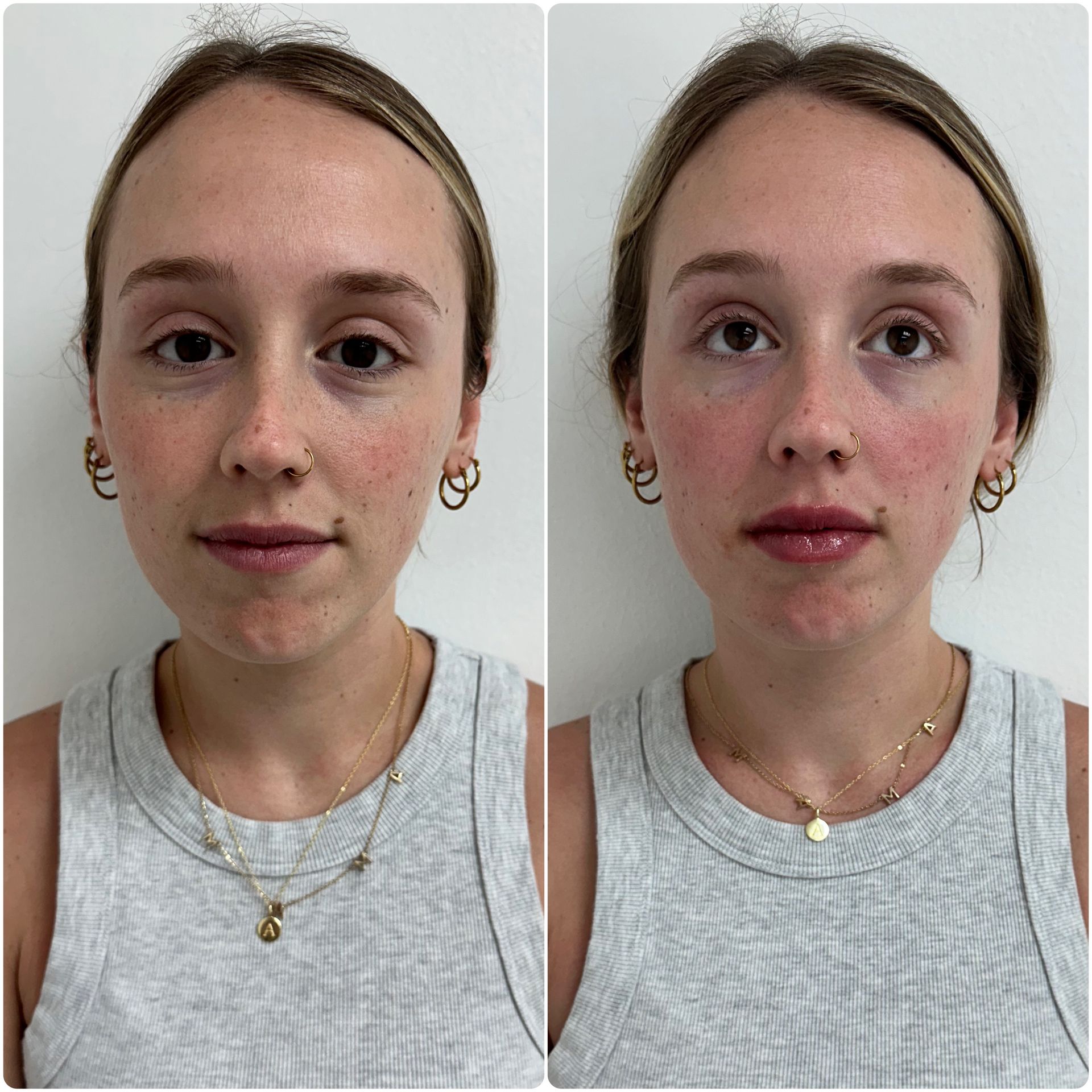 A before and after photo of a woman 's face.