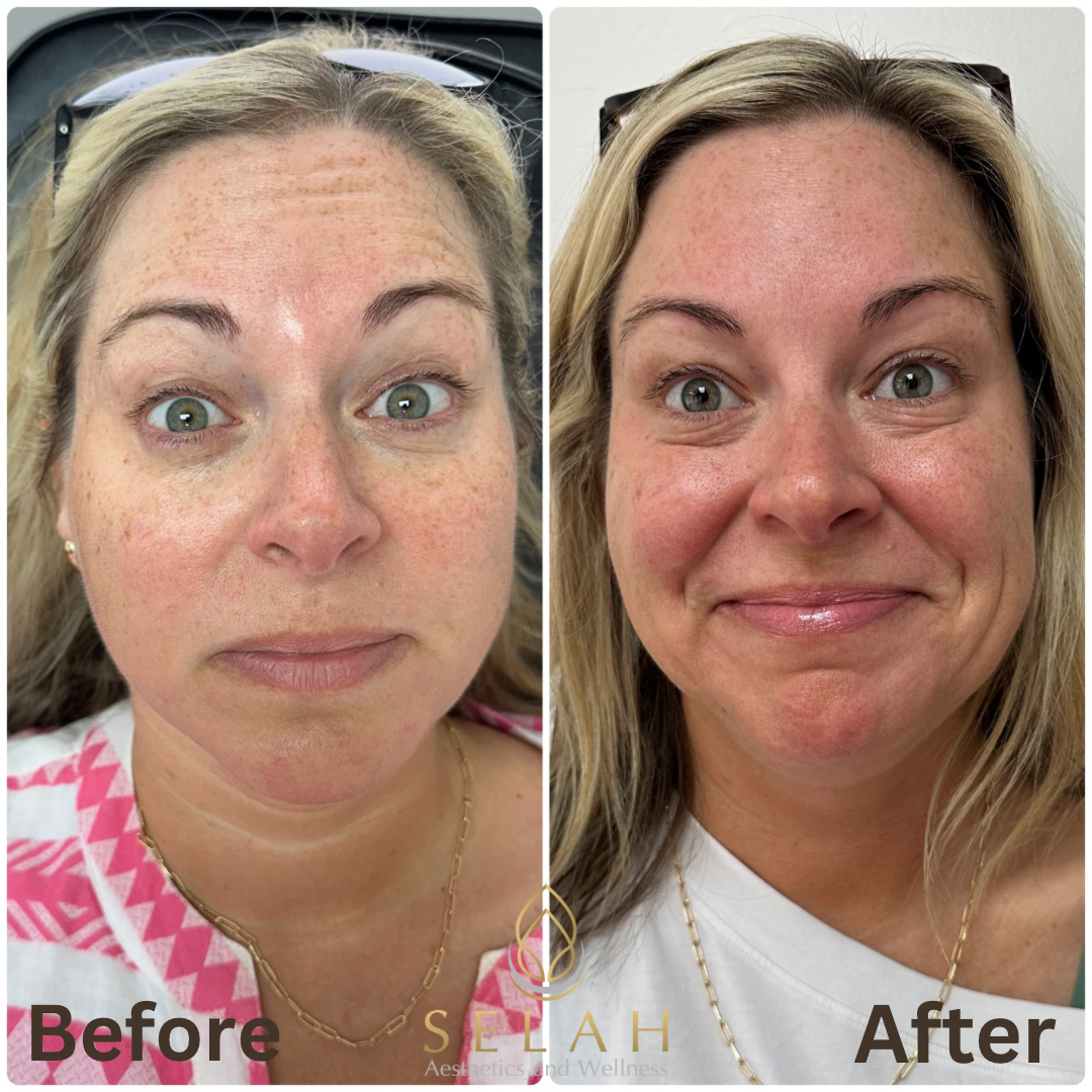 A before and after photo of a woman 's face