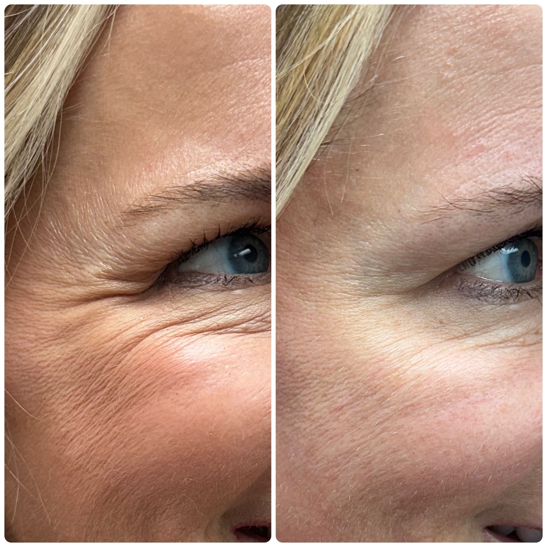 A before and after photo of a woman 's eyebrows.