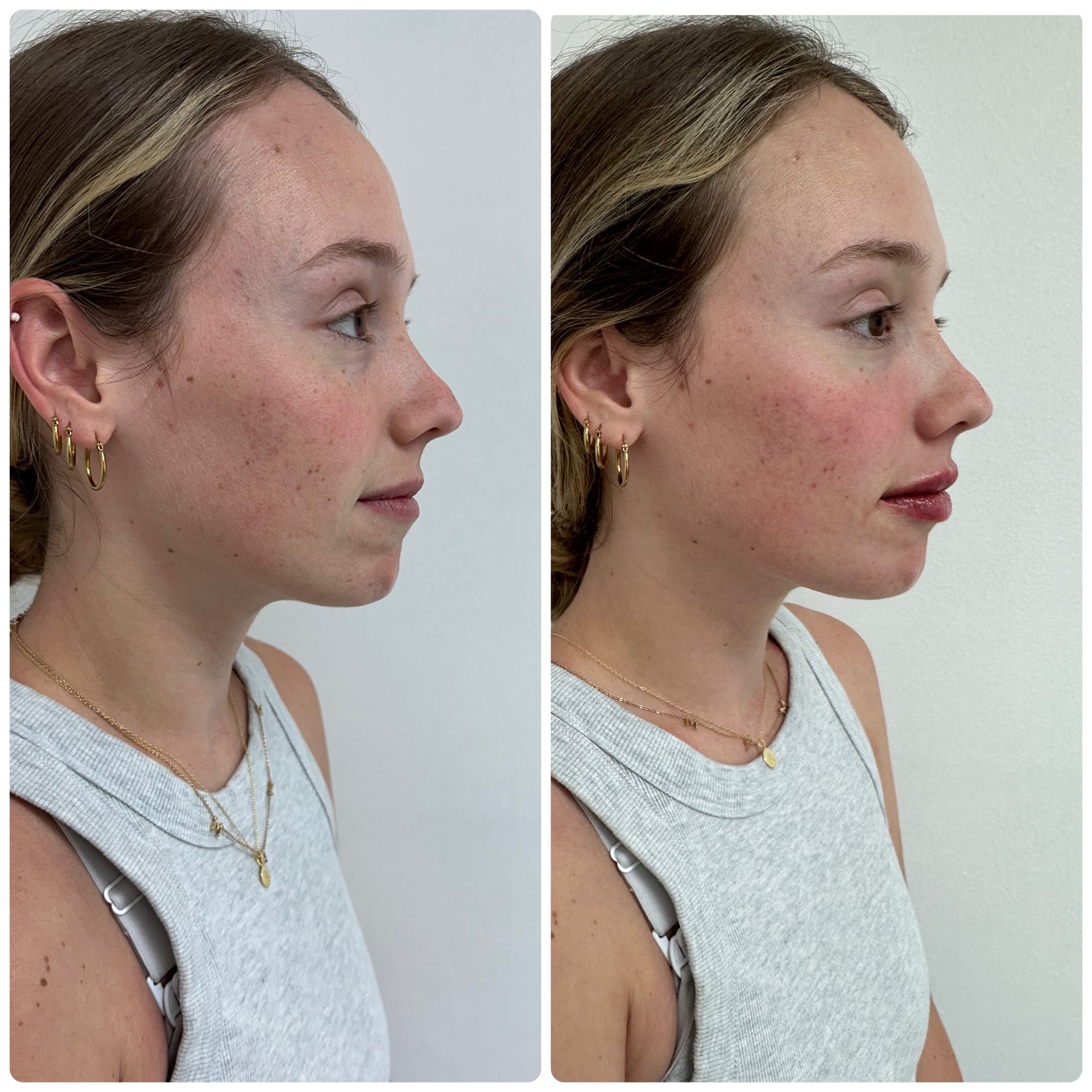 A before and after photo of a woman 's face.