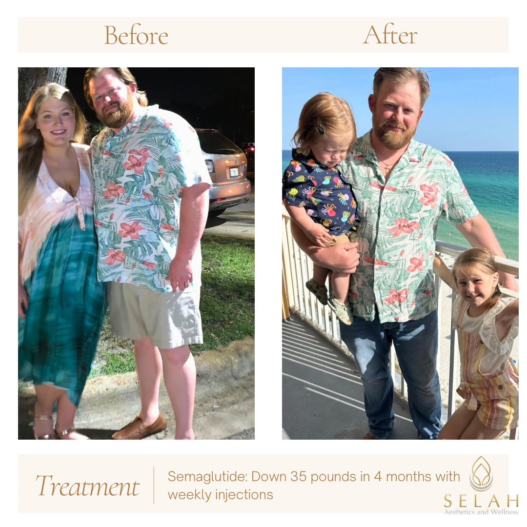 A before and after photo of a man holding a child.